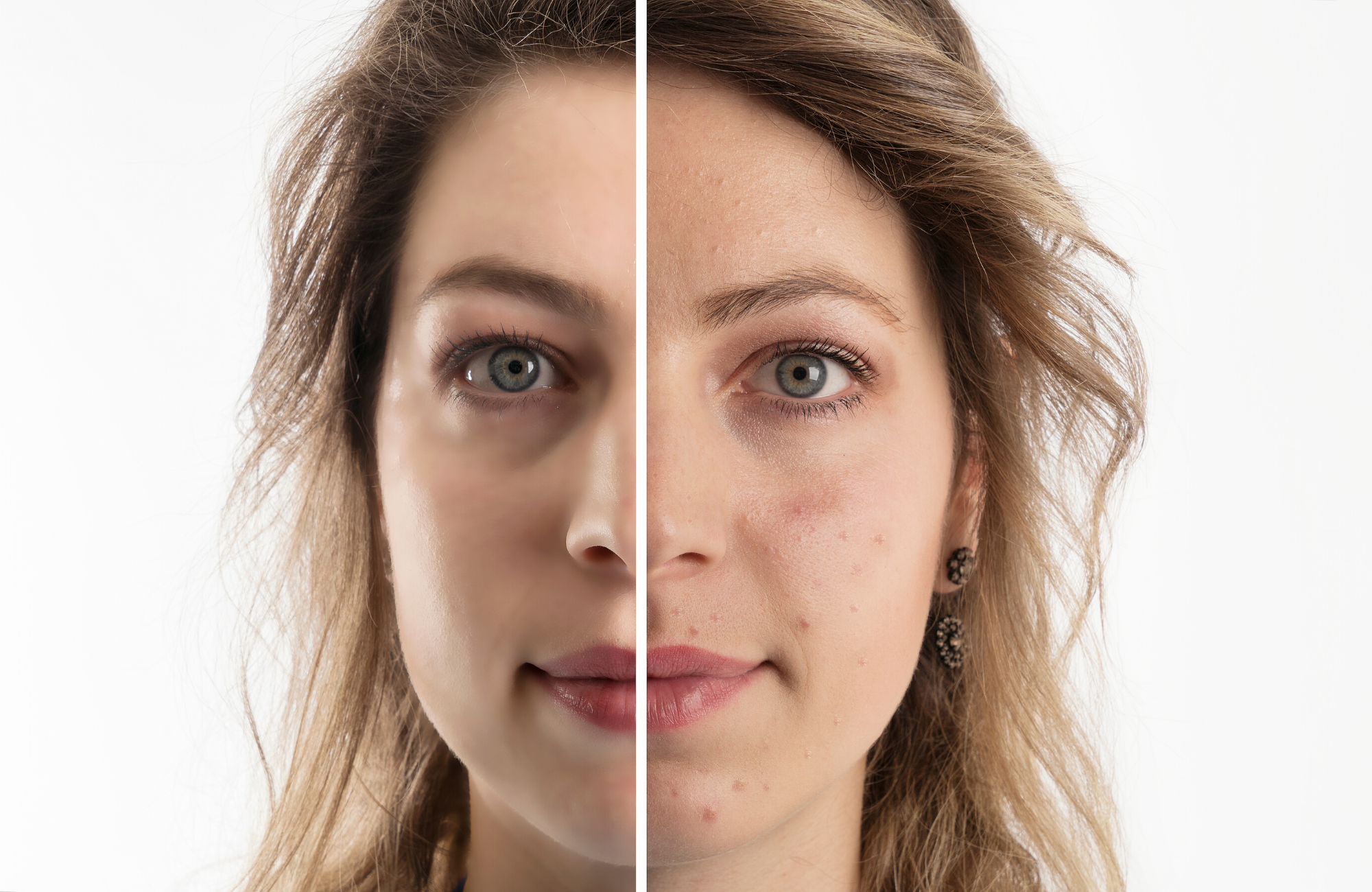 Best Acne-fighting skin care habits. Lauda Botanicals Skincare